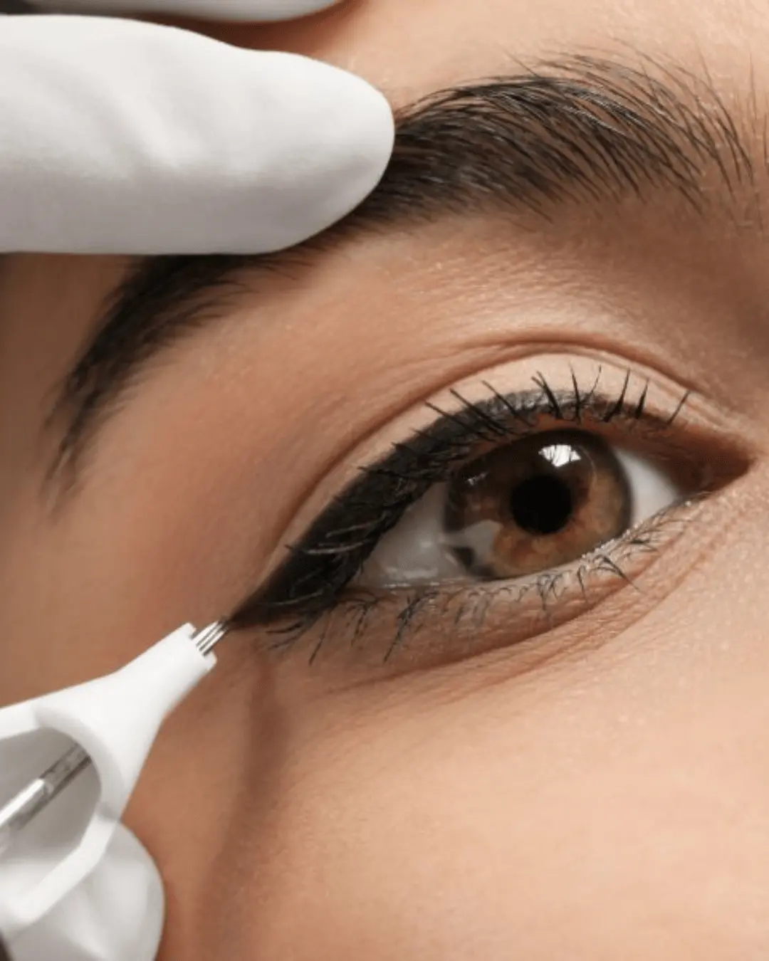 Precision cosmetic eyeliner tattoo