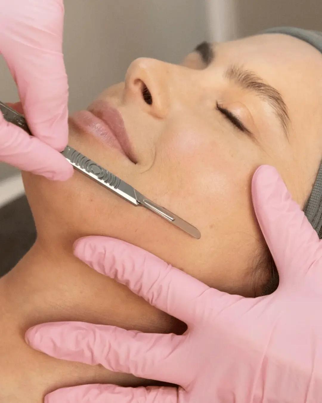 Dermaplaning skin exfoliation